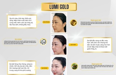 Chiết Xuất Từ Các Thảo Dược Thiên Nhiên